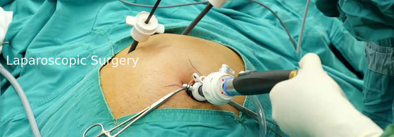 Laparoscopic Surgery