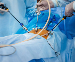 Dos and Don'ts after Laparoscopic Surgery