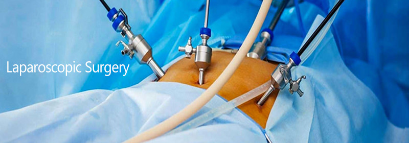 Laparoscopic Surgery