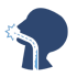 Esophageal Cancer