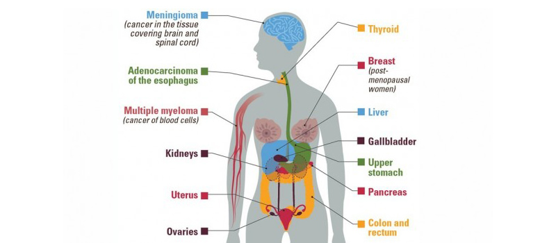 Types of Cancer